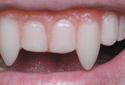 Teeth & Fangs
